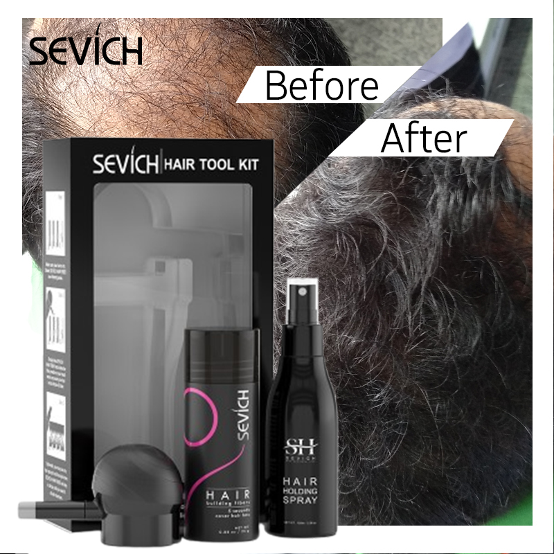 Black Hair Fibers Set Hair Gro - Keratin Treatment Set recension och pris